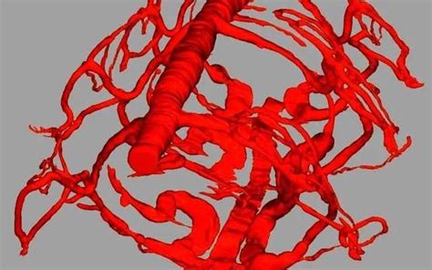 血红蛋白从何起源？血红蛋白进化新观点进化基因新浪新闻