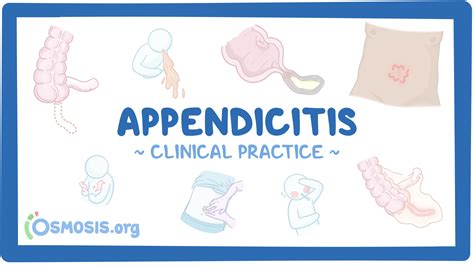 Pathophysiology Of Appendicitis Osmosis Appendicitis Osmosis – Ecosdeltorbes