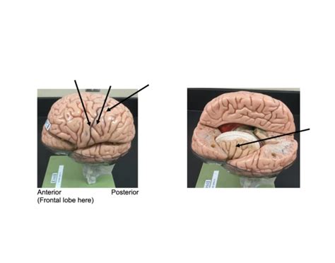 Various Gyri and Insular Lobe Quiz