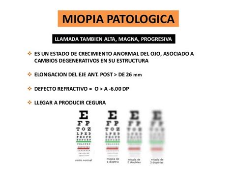 Miopia nocturna, inducida, magna