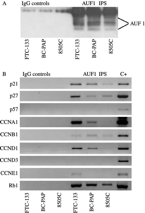 Immunoprecipitation Of Auf Mrna Complexes In Thyroid Carcinoma Cell