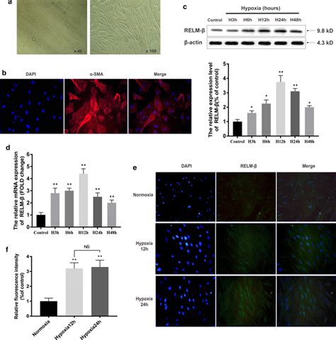 Hypoxia Induces Relm Expression In Primary Cultured Pasmcs In A