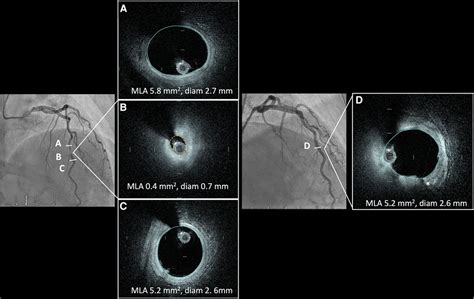 Frontiers Experience With A Novel High Frequency Optical Coherence