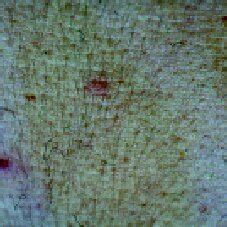 Rose spots-like skin lesion on the trunk (day 4). | Download Scientific ...