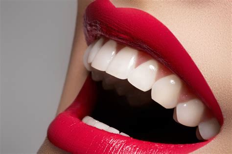 Enhance The Beauty Of Your Smile With The Help Of Dental Aesthetics A