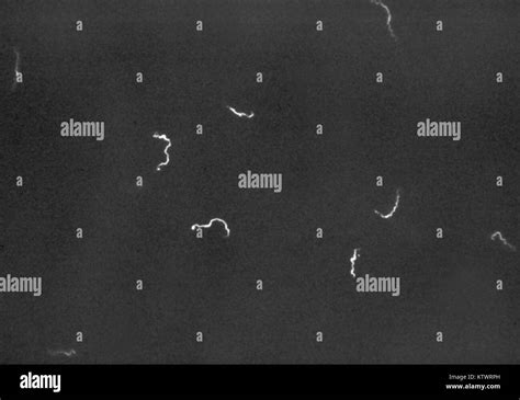 Dark Field Photomicrograph Of Treponema Pallidum Bacteria Control