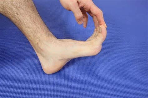 BEST Big Toe Joint Sprain Treatment [Turf Toe HOME Treatment]