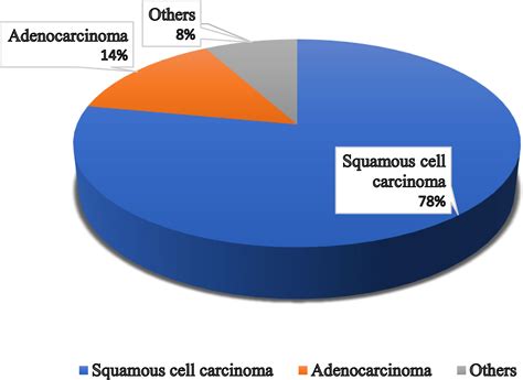 Vaginal Cancer Vaginal Cancer | PPT