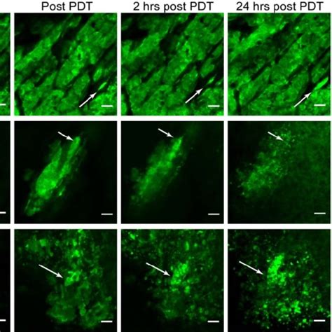 Nanobody Ps Are Phototoxic To Egfr Overexpressing Cells Phototoxicity Of Download Scientific