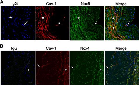 Localization Of Nox Isoforms And Caveolin Cav In Humans Small