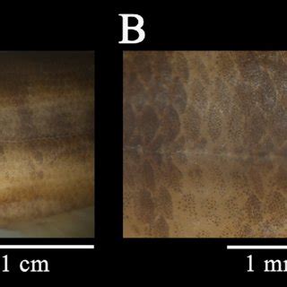 Scales A Scale From Above Lateral Line Below Dorsal Fin Of Schistura