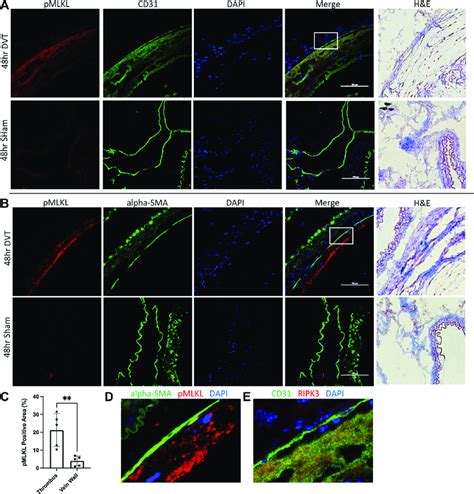 Phosphorylated Mixed Lineage Kinase Domain Like Pseudokinase Pmlkl