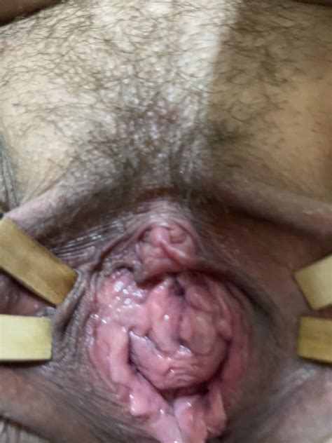 Clitoris Porn Pics Nude Women In Free Sex Photos XHamster