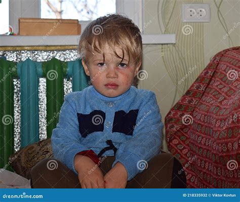 A Little Boy With A Face Smeared With Paint Sits With Tears In His Eyes