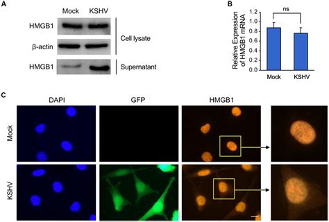 Frontiers Hmgb1 A Potential Regulator Of Tumor Microenvironment In