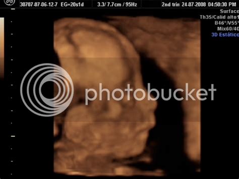 adbanasa: 3d ultrasound 20 weeks boy