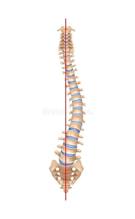 Composición De La Columna Vertebral De Escoliosis Realista Ilustración