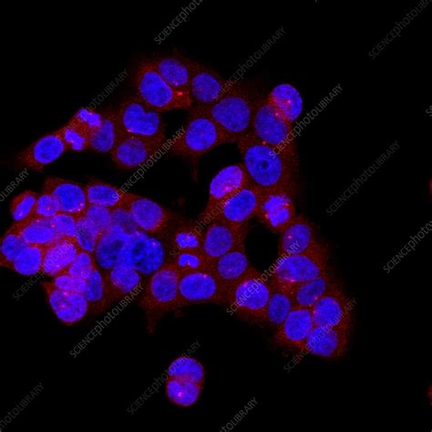 Mitosis Confocal Light Micrograph Stock Image C045 7064 Science Photo Library