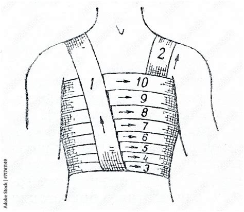 Spiral Bandage Of Chest Stock Illustration Adobe Stock