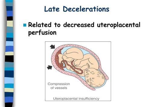 Ppt Fetal Monitoring Powerpoint Presentation Free Download Id 5180473