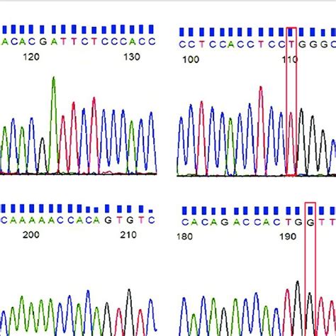 Representative Chromatogram Of Corresponding Dna Sequence Showing Download Scientific Diagram