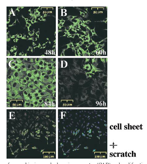 Figure From Imatinib Mesilate Inhibits Neointimal Hyperplasia Via