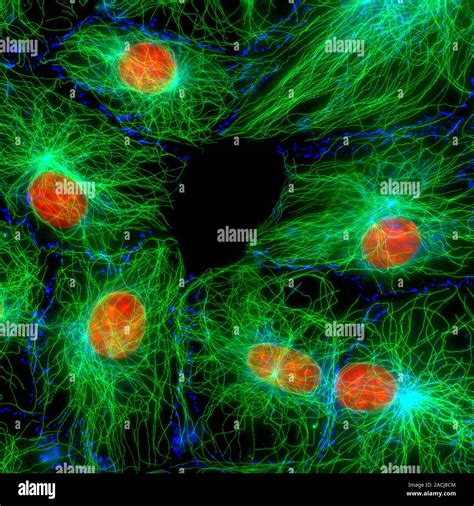 Fibroblast cells. Immunofluorescence micrograph of fibroblast cells ...