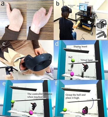 Frontiers Case Report Virtual Reality Training For Phantom Limb Pain