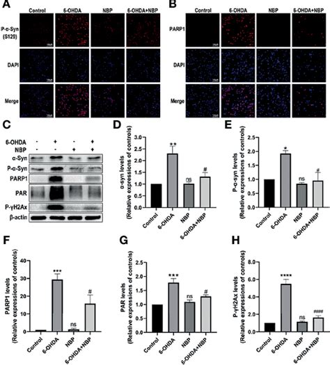 Figure From Dl N Butylphthalide Rescues Dopaminergic Neurons In