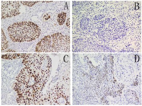 Expression Of Oct4 And Sox2 Immunohistochemical Staining For Oct4 And Download Scientific