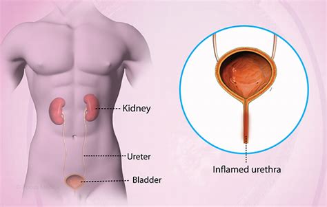 Health Condition : Symptoms, Causes, Treatment and More