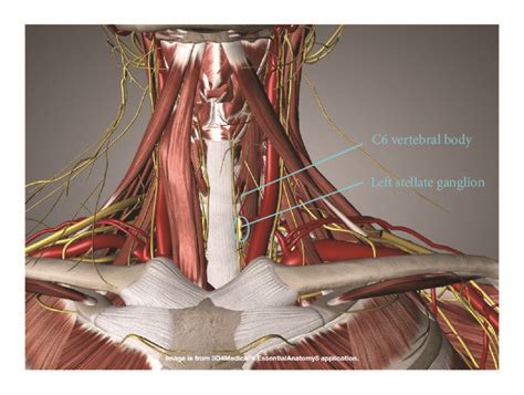 Stellate Ganglion