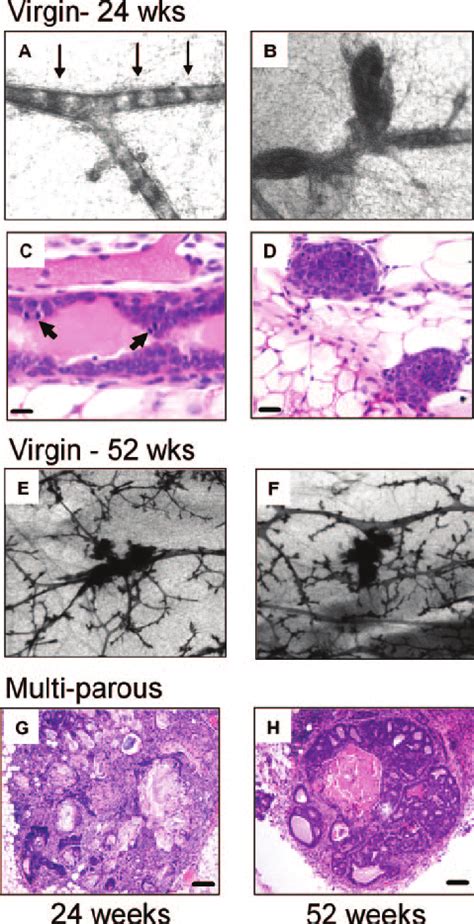 Progressive Mammary Hyperplasia In Mmtvhairs Transgenic Mice A To