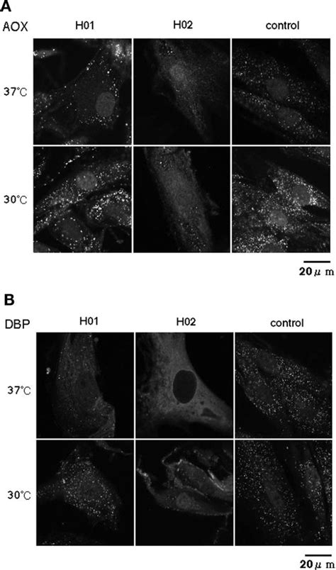 Molecular Mechanism of a Temperature-Sensitive Phenotype in Peroxisomal ... 