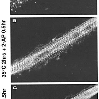 The serine/threonine kinase inhibitor 2-AP and the phorbol ester PDD ... 