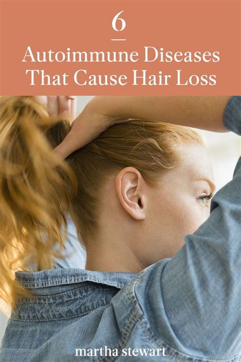 Six Autoimmune Diseases That Cause Hair Loss Hair Loss Hair Loss