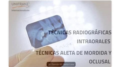 TÉCNICAS RADIOGRÁFICAS INTRAORALES TÉCNICAS ALETA DE MORDIDA OCLUSAL