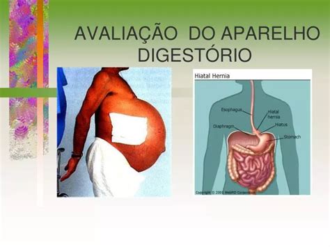 Ppt Avalia O Do Aparelho Digest Rio Powerpoint Presentation Free