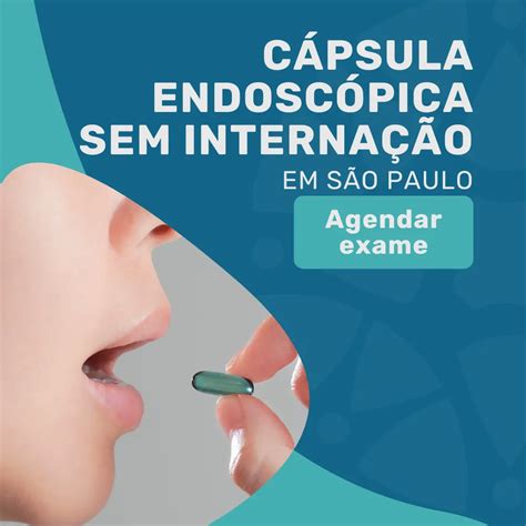 Cápsula Endoscópica Valor Do Exame - Valor da cápsula endoscópica em São Paulo sem internação