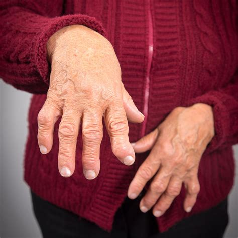 Scientists Developed an Experimental Vaccine Against Rheumatoid