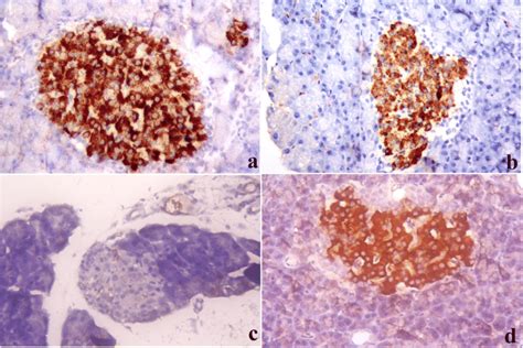 Immunohistochemistry Stain Of The Pancreatic Islets Of The Different