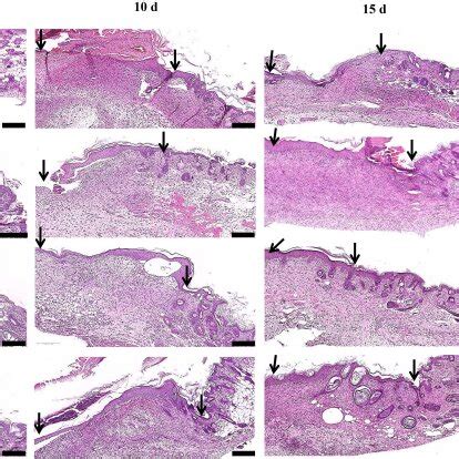 Hematoxylin And Eosin Staining Of Skin Biopsies Showing Wound Healing