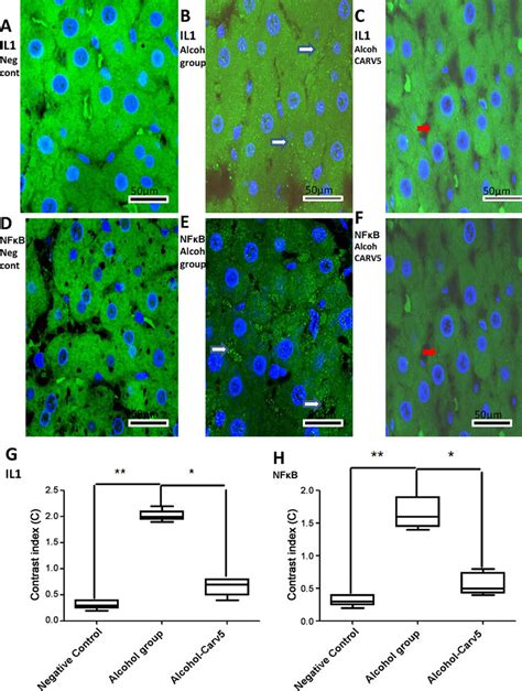 CARV modulates IL 1β and NF κB expression Representative confocal