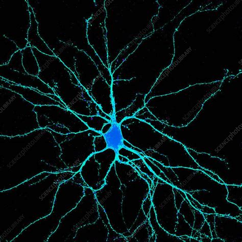 Neuron Fluorescence Micrograph Stock Image C Science Photo