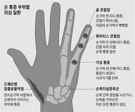 손가락 첫 마디 통증 골관절염 둘째 마디는 류마티스