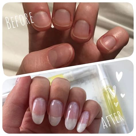 Nail Growth Serum Cuticle Nail Oil For Cracked Brittle Etsy