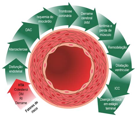 Fisiologia Da Hipertensão Arterial Sistêmica Braincp