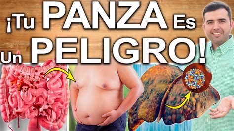 Tu Panza No Es Buena Sea Al Enfermedades O Problemas De Salud Por