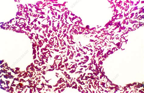 Pseudomonas aeruginosa - Stock Image - C025/2929 - Science Photo Library