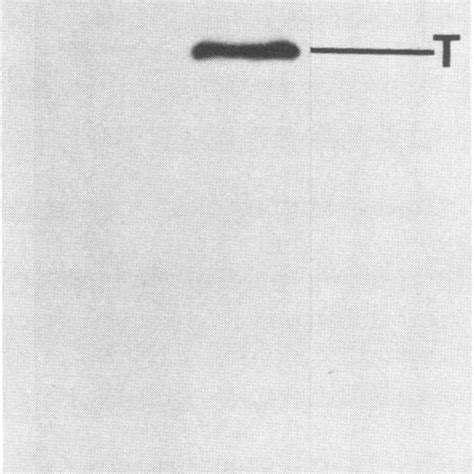 Sds Polyacrylamide Gel Autoradiogram Of Distribution Of L25l Labeled